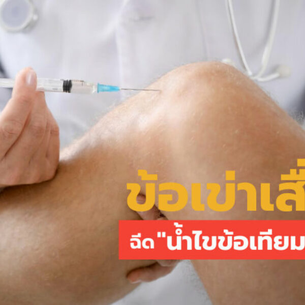 ข้อเข่าเสื่อม น้ำไขข้อเทียม - - คลินิกกระดูกและข้อหมออโนชา ลำพูน